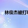 林俊杰被打事件原因2021（林俊杰被打）