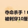 夺命杀手！电动自行车安装遮阳伞 女子脸部被刺穿10厘米