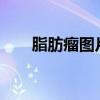 脂肪瘤图片?（脂肪瘤长什么样图片）