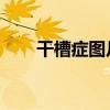 干槽症图片 前兆（干槽症症状图片）