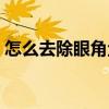 怎么去除眼角鱼尾纹（怎样去除眼角鱼尾纹）