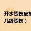 开水烫伤皮掉了属于几度烫伤（开水烫掉皮属几级烫伤）