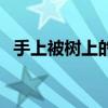 手上被树上的刺刺到怎么办（手在树上为）