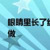 眼睛里长了红血丝不要轻视！5件事你一定要做