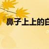 鼻子上上的白头（鼻子上的白头是螨虫吗）