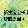 新生宝宝长湿疹是什么引起的（新生宝宝长湿疹的原因）