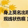 身上莫名出现线状伤痕百度知道（身上莫名出现线状伤痕）