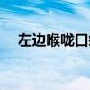 左边喉咙口疼（左边喉咙痛是食道癌吗）