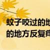 蚊子咬过的地方反复痒是什么原因（蚊子咬过的地方反复痒）