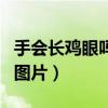 手会长鸡眼吗是啥样子的（手上会长鸡眼初期图片）