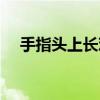 手指头上长鸡眼的图片（长鸡眼的图片）