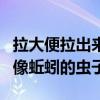 拉大便拉出来虫像蚯蚓一样的活的（拉屎拉出像蚯蚓的虫子）