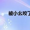 被小幺咬了（被小咬咬了涂什么药好）