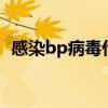 感染bp病毒什么症状（bp5病毒是真的吗）