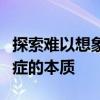 探索难以想象的事物：新数据有助于理解失语症的本质