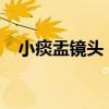 小痰盂镜头：深度解析其特点与应用领域